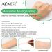 Professional Silicone Scar Sheets - Stretch Mark, Surgery, Injury, Burns, Acne, Keloid, C-Section Treatment - Reusable Scar Patches for Old & New Scars - 3 1.6x4 Sheets (60 Day Supply) - Buy Online on GoSupps.com