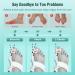 Upgraded-Fit Bunion Corrector - Orthopedic Splint for Men & Women | Adjustable Big Toe Straightener for Bunion Relief (1PCS) - Ultra-Comfy Design - Buy Online on GoSupps.com