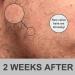 OCHILIMA Beard Growth Kit - Derma Roller & Beard Oil for Men - Stimulate New Hair Growth - Buy Online on GoSupps.com