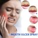Mouth Spray for Soothing Relief | Mouth Ulcer & Sores Care | International Shipping - Buy Online on GoSupps.com