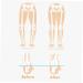 Orthopedic Insoles for Leg Correction | Bow Legs & Strephexopodia Support | Men's Boot & Flat Shoe Inserts - Buy Online on GoSupps.com