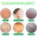 Natural Herbal Eczema & Psoriasis Repair Cream - Anti-Itch Relief for Dry, Red, and Rough Skin - 0.7 oz - Buy Online on GoSupps.com