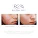 DERMA E Vitamin C 10% Multi-Acid Radiance Liquid Peel - Brightening Exfoliating Treatment for Uneven Skin Tone | Niacinamide Lactic Acid & Bromelain - 1 Fl Oz - Buy Online on GoSupps.com