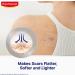 Elastoplast Scar Reducer Plasters - 21 Patches for Quick Results - Clear Skin Treatment - Buy Online on GoSupps.com