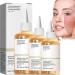 Glycolic Acid 7% Toning Resurfacing Solution -Glycolic Acid 7% Toning Resurfacing Solution for Blemishes and Acne Anti-Aging Freckle Removal Acne Tighten Pores 3bottles - Buy Online on GoSupps.com