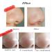 Thailand Blackhead Remover Cream - Deep Cleansing for Pores, Acne, and Pimples - 1 Box - Buy Online on GoSupps.com