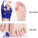 Bunion Toe Separator Splint - Comfortable Wear, Adjustable Strength, Pain-Free Movement - Prevent Deviation, Soft Fabric - Daily Use (Right) - Buy Online on GoSupps.com