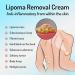 Lipoma Removal Cream Cr me d' limination de lipomes Cellulite Removal Exfoliating Cream Get Rid of Your Fatty Lipoma Lumps (2pcs) - Buy Online on GoSupps.com
