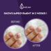 V20 Vite 20 Antifungal Cream - Nail Fungus Killer for Hands and Feet Treatment - Buy Online on GoSupps.com