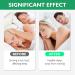 Snore Stopper Kit: 12 Pcs Anti-Snoring Nose Clips and Vents for Men and Women - Snoring Solution that Works - Buy Online on GoSupps.com