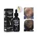 MINOXIDIL 5% Hair Growth Serum with Biotin & Collagen for Men - Hair Regrowth & Loss Treatment - Buy Online on GoSupps.com