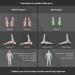 EZXM Arch Support Orthotic Custom Insoles - Plantar Fasciitis Relief - Men 9.5-10 / Women 10.5-11 - Buy Online on GoSupps.com