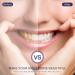 Purple Teeth Whitening Booster - Stain Removal & Yellowing Reduction - 30ml - Buy Online on GoSupps.com