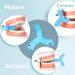 Nuanchu Aligner 4-Piece Y Shaped Tray Set for Teeth & Metal Braces | Colorful Aligner for Chompers (Red Blue Purple Yellow) - International Shipping Available - Buy Online on GoSupps.com