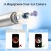 Shop Bebird Ear Wax Removal Tool with Camera - 1080P Otoscope & 9 Picks - Compatible with iPhone iPad & Android - International Shipping Available - Buy Online on GoSupps.com