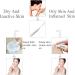 High Frequency Facial Wand Machine FAZJEUNE 4 in 1 Portable Frequency Face Massager Face Care Skin Tightening Machine Set Acne Spot Treatment Kit Reducing Puffy Eyes Wrinkles Dark Circles Freckle - Buy Online on GoSupps.com