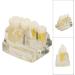 Verdant Touch Dental Implant Model | Transparent Dental Implant for Teaching & Research | International Shipping - Buy Online on GoSupps.com