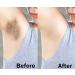 Go Ho Skin Whitening Cream | Skin Bleaching & Dark Spot Remover for Face & Body | Lightening Cream for Intimate Areas Armpits Knees & Elbows | 1.06oz - Buy Online on GoSupps.com