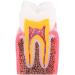 Buy Caries Comparison Study Models | Dental Anatomy Teeth Models for Dentist Education - International Shipping - Buy Online on GoSupps.com
