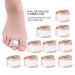 Hallux Valgus Finger Divider - 10 Piece Set | Alleviate Bunions & Foot Pain | International Shipping - Buy Online on GoSupps.com