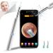Wireless Endoscope Ear Wax Removal Kit | 1080P FHD WiFi Ear Cleaner with LED Lights | Ear Pick for Adults, Kids & Pets - Buy Online on GoSupps.com