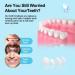 Smile Teeth Veneers - 50 Premium Temporary Crowns for Bad Tooth Coverage | Fast Styling & Healthy Materials | Includes Storage Box - Perfect for Cosmetic Dentistry - Buy Online on GoSupps.com