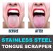 Premium Stainless Steel Metal Tongue Scraper for Oral Health - Eliminate Bad Breath & Clean Toxins - Buy Online on GoSupps.com