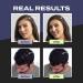Toppik Dark Brown Hair Building Fibers - Thinning Hair Thickener for Fuller Appearance - 0.42 OZ - Buy Online on GoSupps.com
