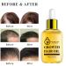 Natural Hair Regrowth Serum - Fast Growth & Strengthening Treatment with Rosemary Oil & Biotin | Organic & Effective Solutions for Thinning Hair - Buy Online on GoSupps.com