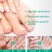 30ml Kerassentials Toenail Fungus Treatment Oil 3Pcs Kerassentials Oils for toenail Fungus - Buy Online on GoSupps.com