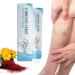 Raura Varicose Veins Treatment Cream, Raura Varicose Veins Cream, Varicose Veins Treatment for Legs (1)
