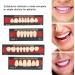 Temporary Tooth Repair Set - Synthetic Resin Filling for Lost Teeth | Dental Care Tools for International Shipping - Buy Online on GoSupps.com
