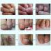 Allbesta Enzymatic Gel & Repair Film Toe Nail Rescue Set Ultimate Nail Care for Healthy Nails & Cuticles - Buy Online on GoSupps.com
