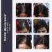 Super Million Hair 15g - No.2 Dark Brown: Instant Hair Loss Concealer - Buy Online on GoSupps.com