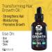 IQ Natural Jamaican Black Castor Oil for Hair Growth - Organic Bald Spot Treatment for Women and Men | Itchy Scalp Treatment | Beard Growth Serum | Hair Serum for Dry Hair - Buy Online on GoSupps.com