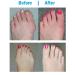 Elastic Bunion Corrector & Relief Sleeves - Hallux Valgus Protection Tool for Toe Extensor Care - Buy Online on GoSupps.com