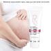 Stretch Mark Cream - Effective Pregnancy & Scar Treatment | Elimina Estr as - Buy Online on GoSupps.com