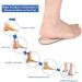 Haofy Heel Pillow Cushion Gel 2 Pairs of Heel Spur Inserts for Plantar Fasciitis & Achilles Tendon Relief 7mm Silicone Heel Protection for Men | 4 Pieces - Buy Online on GoSupps.com
