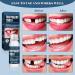 Temporary Tooth Set Tooth Repair Kit Temporary Teeth Replacement Kit for Chipped Teeth Moldable False Teeth Temporary Filling for Tooth - Buy Online on GoSupps.com