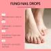  Byuexhp Nail Care Drops - 15ml Fortifying Moisturizing and Regenerating Toenail Treatment Repair Kit for Damaged Nails for Adults Lovers Family Friends Mom Dad - Buy Online on GoSupps.com