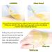 LANBENA Retinol Hydra-Gel Eye Mask with Collagen and Hyaluronic Acid - Moisturizing Eye Patches for Dark Circles and Eye Bags - Gold Formula - Buy Online on GoSupps.com
