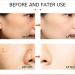 KnjoFly Japanese Melasma Cream Dr Hancy - Herbal Whitening and Dark Spot Remover for All Skin Types - Buy Online on GoSupps.com