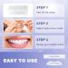 MySmile 56 No Sensitivity Teeth Whitening Strips - 28 Day Treatment for White, Enamel Safe Smile - Buy Online on GoSupps.com