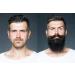 Best Earth Naturals Beard Growth Formula - Vitamins & Nutrients with Biotin Saw Palmetto & PABA for Men - 30 Count - Buy Online on GoSupps.com