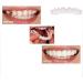 BGZ 5 Couples Perfect Smile Teeth Veneers - Instant Snap-On Dentures for Flawless Smile | Temporary Braces for Imperfect Teeth (5 Upper & 5 Lower) - Buy Online on GoSupps.com