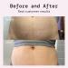 Stretch Marks Cream & Pregnancy Massage Body Butter - 100ml Shea Butter Formula for Reducing & Preventing Stretch Stripes - Buy Online on GoSupps.com