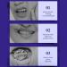 Lianbiquan V34 Purple Toothpaste for Whiter Teeth & Gum Repair | Color Corrector (3PCs) - Best eCommerce International Shipping - Buy Online on GoSupps.com