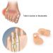 Pinky Toe Gel Cushion Splint | Toe Separators for Men and Women | Prevent Blisters, Corns, and Pain | 5 Pairs-Skin - Buy Online on GoSupps.com
