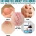Liquid Bandage - Waterproof Skin Adhesive for Wounds & Scratches | Active Skin Repair (10ml) - International Shipping - Buy Online on GoSupps.com