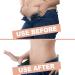 HIDARLING Postpartum Recovery Belly Belt Body Shaper Corset - Women's High Elastic Waist Trainer Belt (Black, Size M) - Buy Online on GoSupps.com
